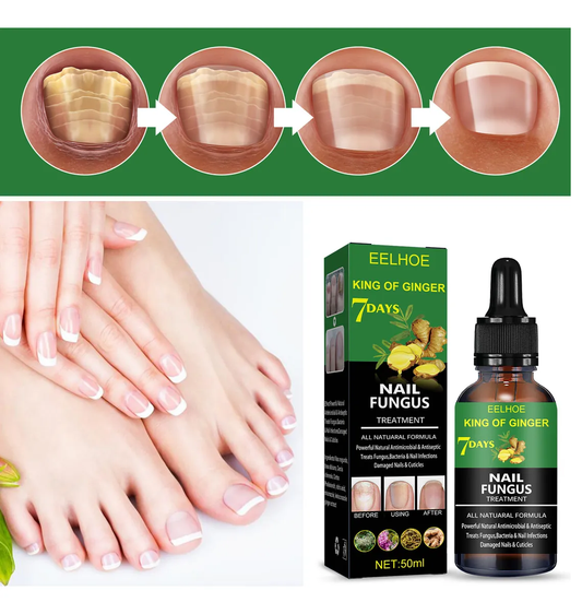 7 DAYS ELIMINA HONGOS $129.000 Cop Hoy